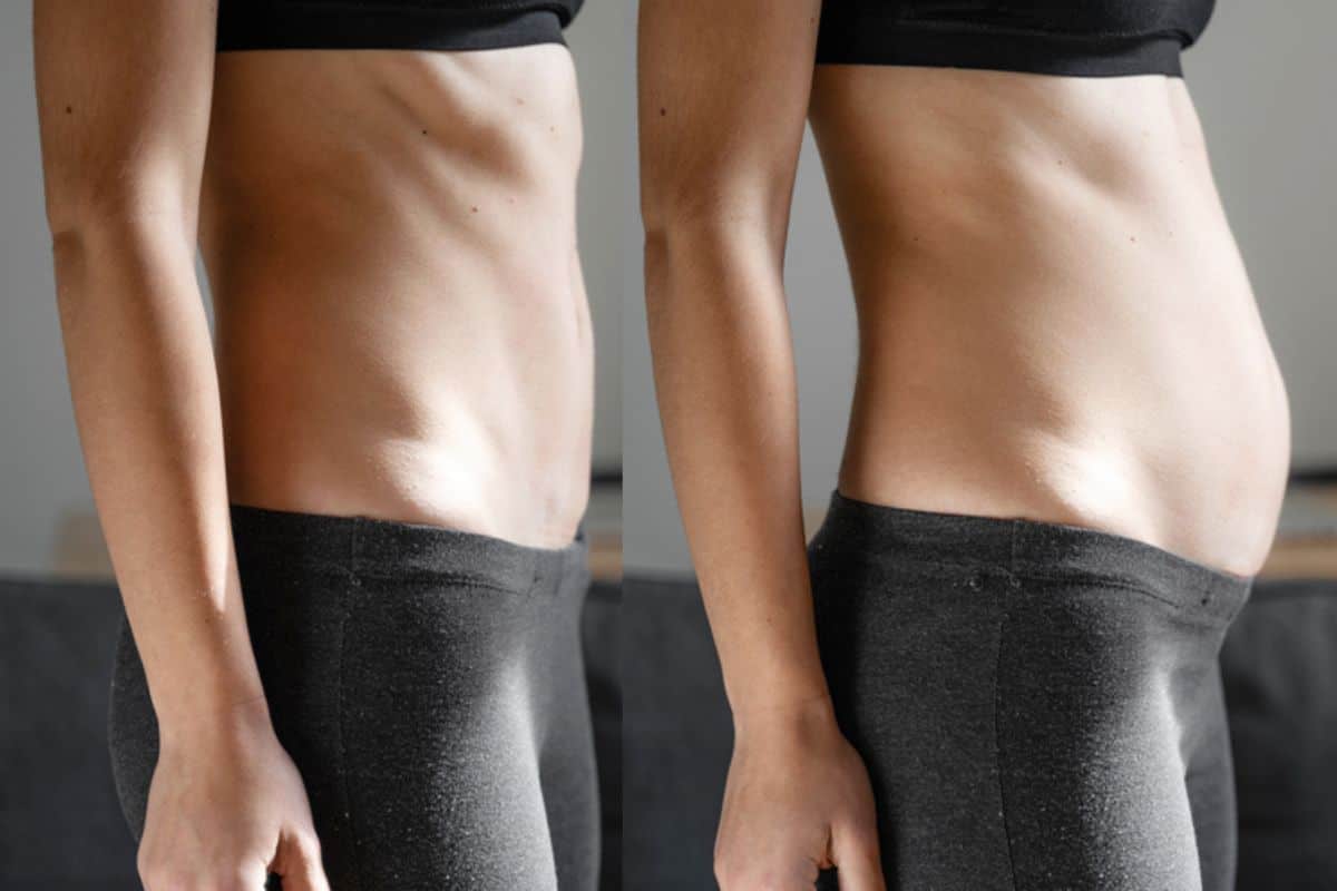 How long does diastasis recti take to improve Redditch?