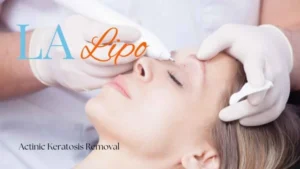 Woman receiving Actinic Keratosis Removal Treatment Redditch
