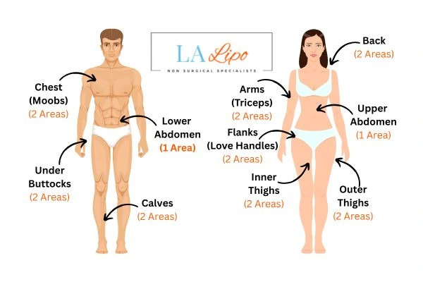 LA LIPO Cryolipolysis Areas Redditch
