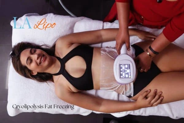 woman getting cryolipolysis Redditch