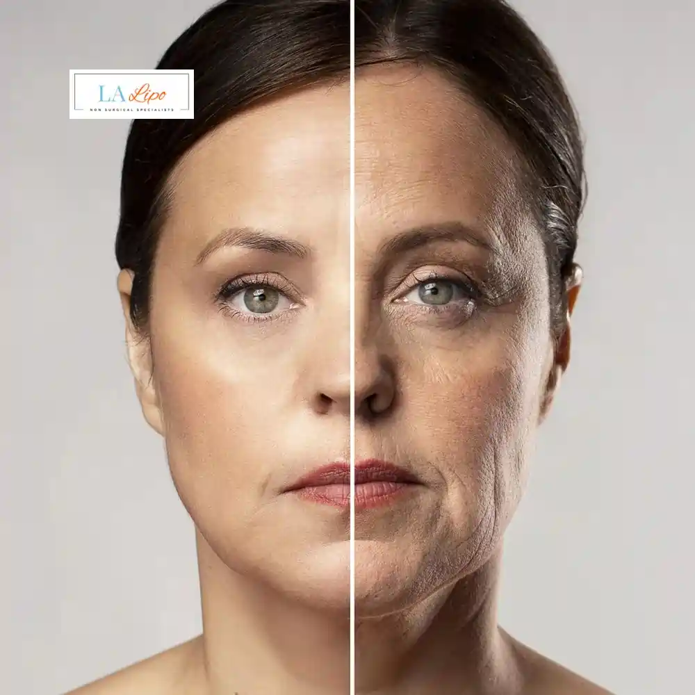 How Can You Tell If Non-Surgical Skin Tightening Is Right for You Redditch?